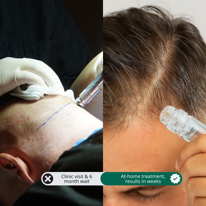 Revive™ - Hair Regrowth system