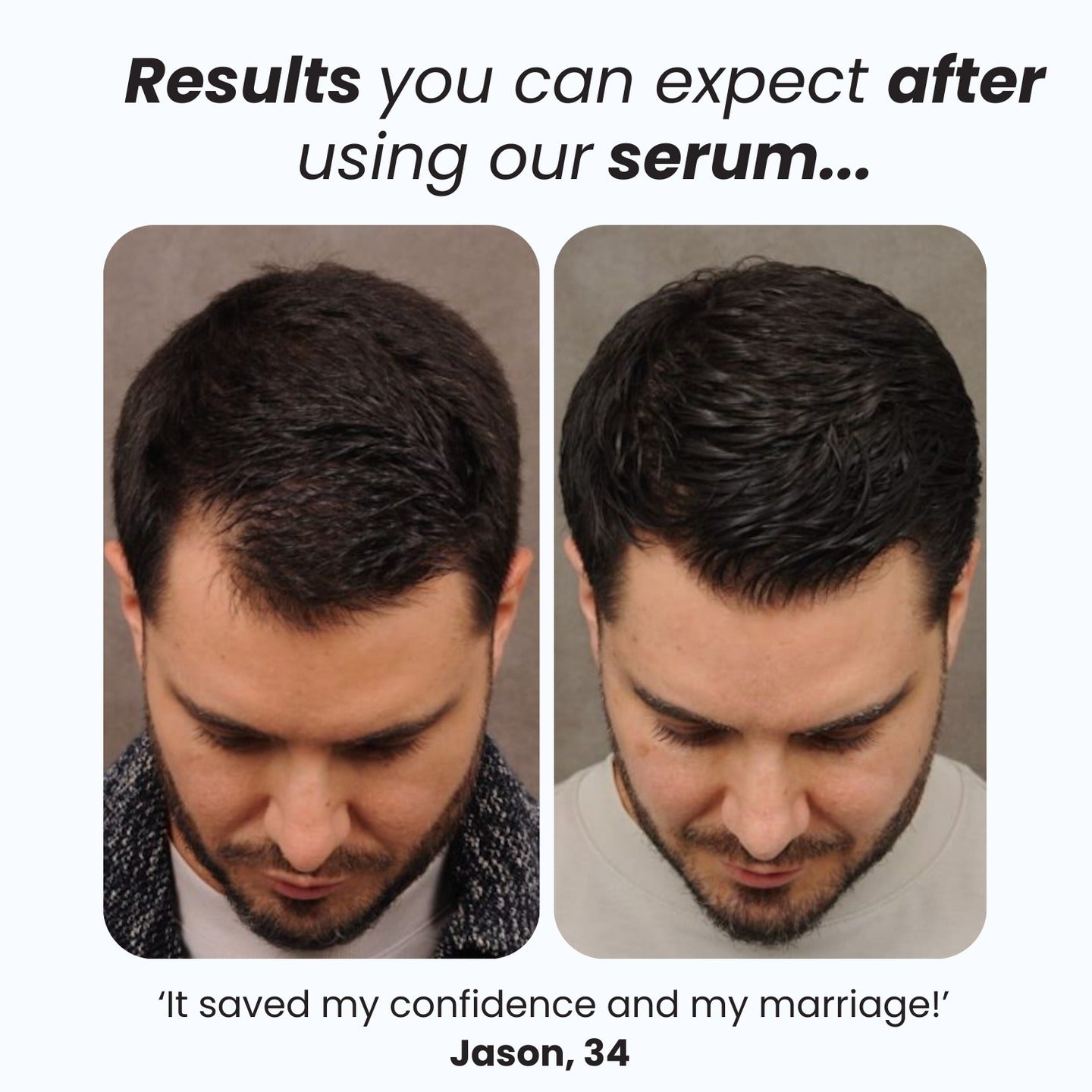 Hair Growth Roll-on for Hair, Beard and Eyebrows