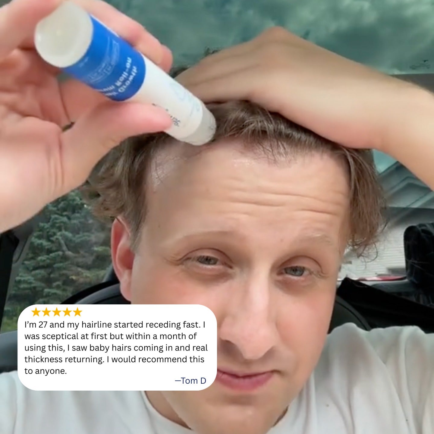 Hair Growth Roll-on for Hair, Beard and Eyebrows